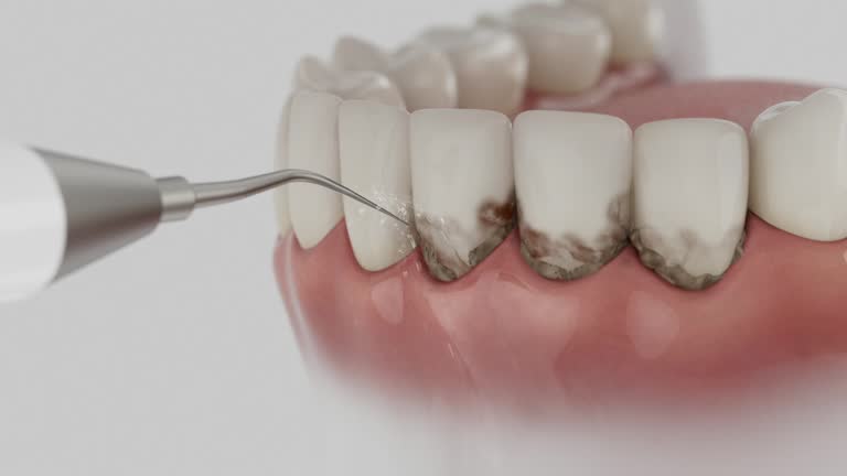 Trusted Teeth Cleaning And Checkup service in Cowan, TN - Dentist Open Now